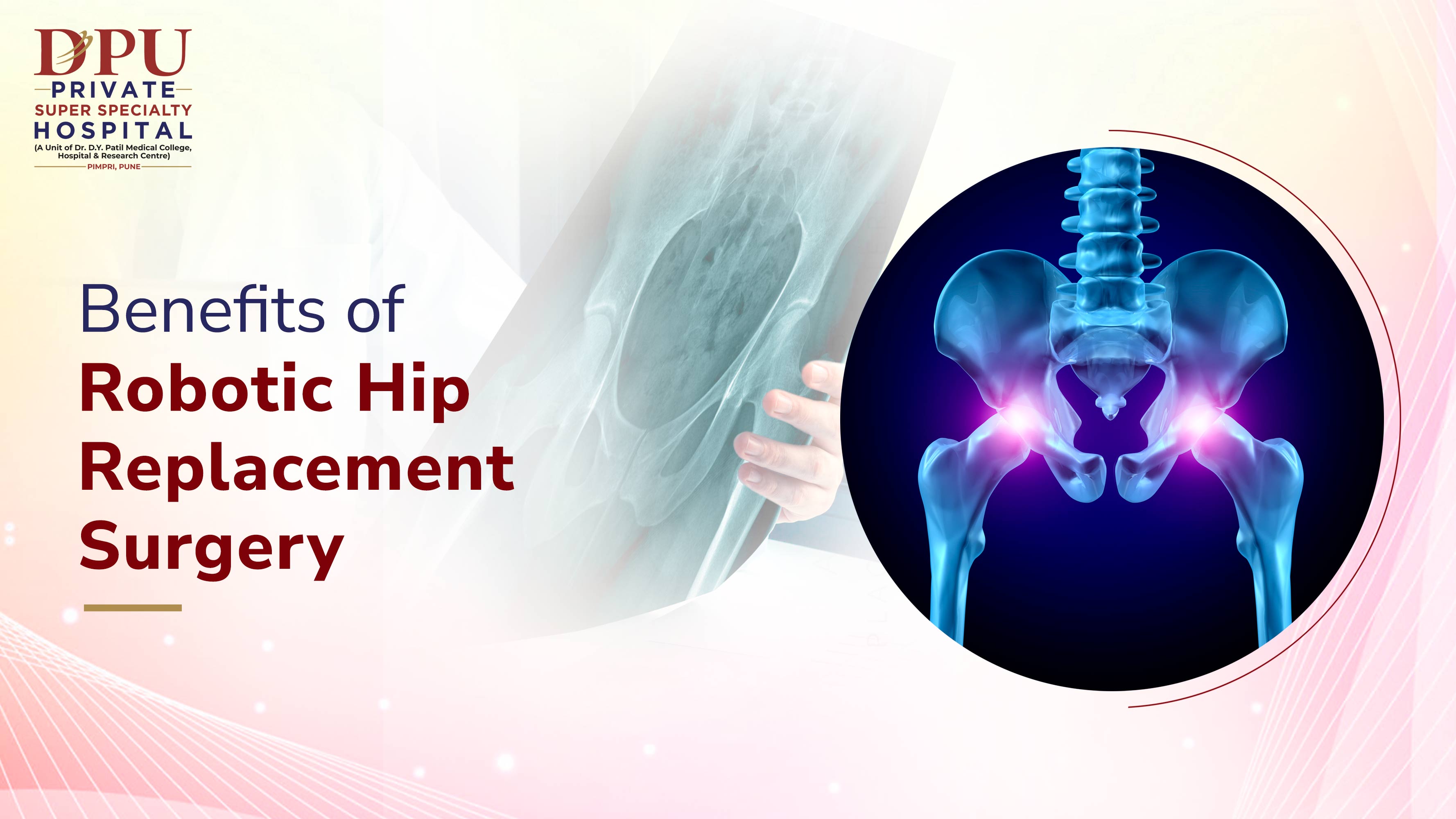 Robotic Hip Replacement Surgery Benefits