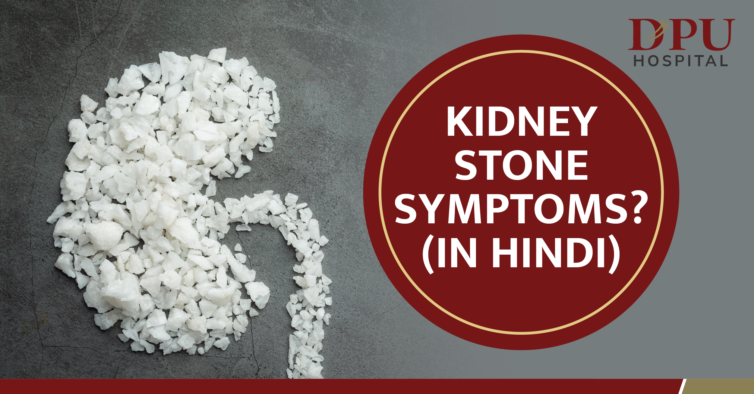 Kidney Stone Symptoms and Treatment